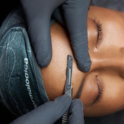 Dermaplaning Upgrade