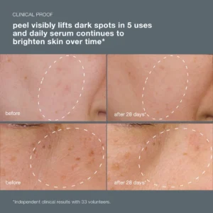 powerbright dark spot system (2 full size)