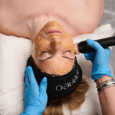 Geneox 5 in 1 super facial